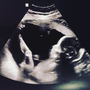 Meet your Posher, Gloria